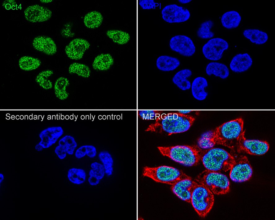 iPS Cell Reprogramming Antibody Kit