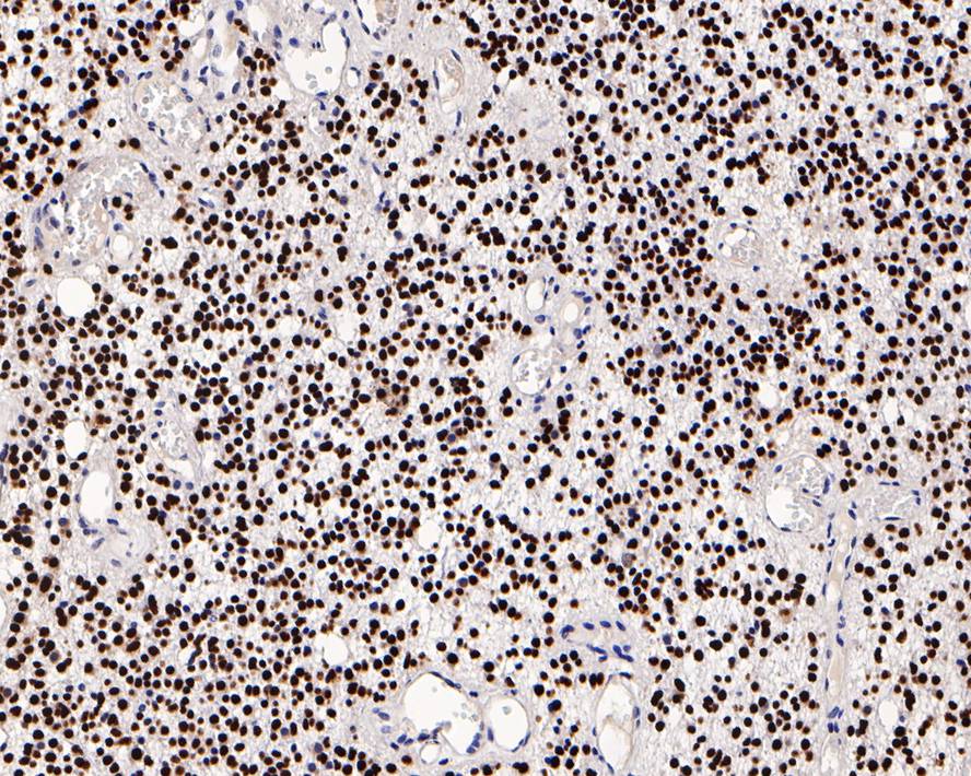 iPS Cell Reprogramming Antibody Kit