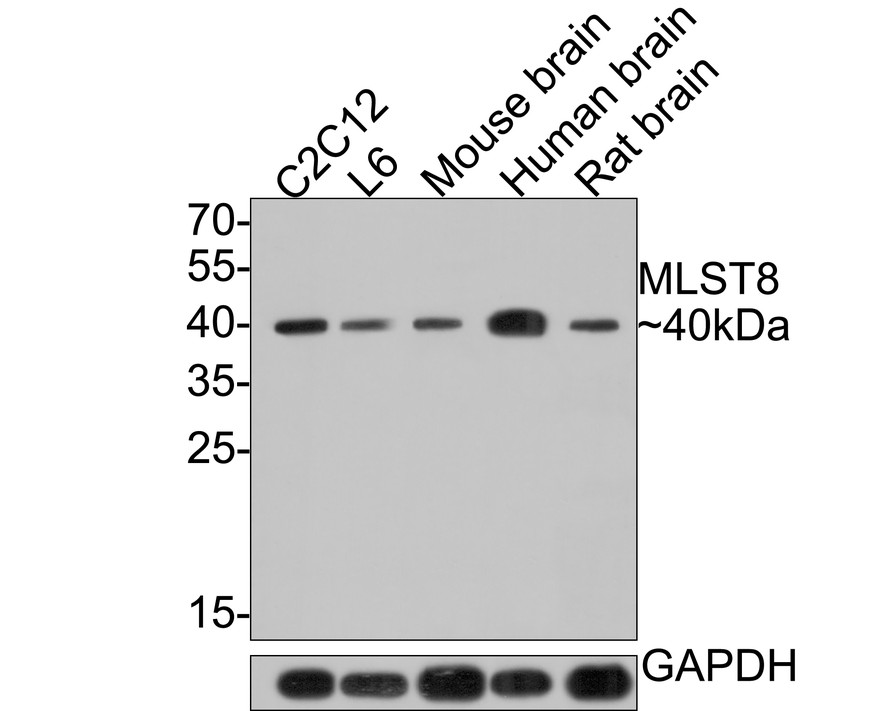 mTOR Pathway Antibody Sampler Kit