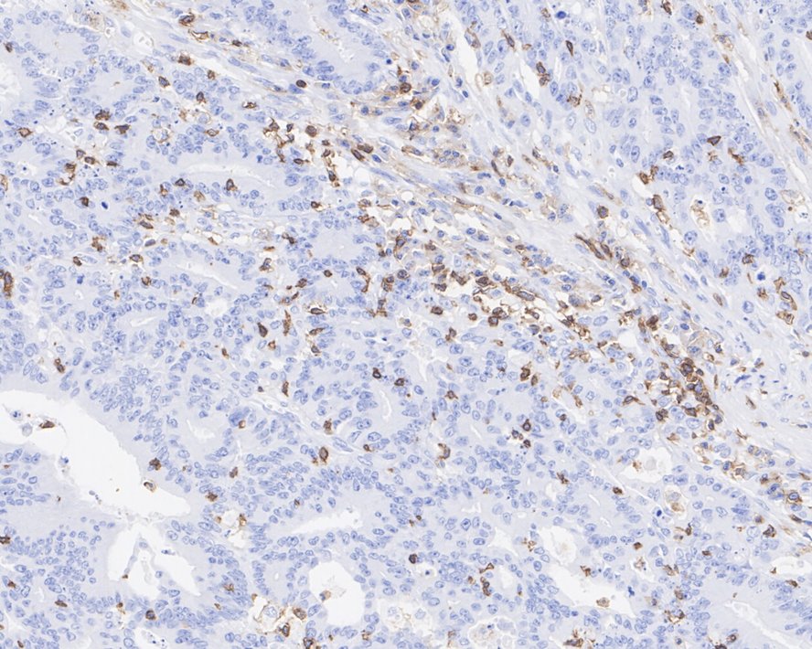 Mesenchymal Stromal Cell Marker Antibody Sampler Kit