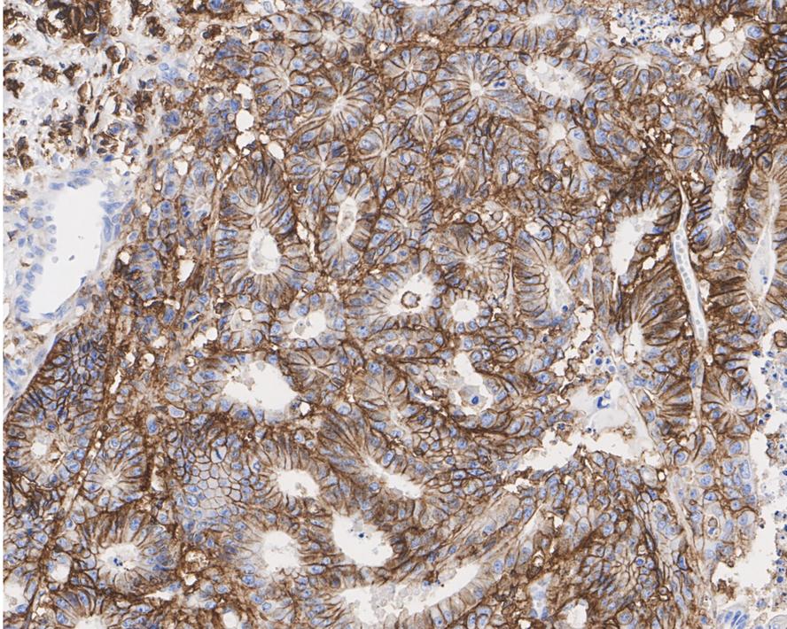 Mesenchymal Stromal Cell Marker Antibody Sampler Kit