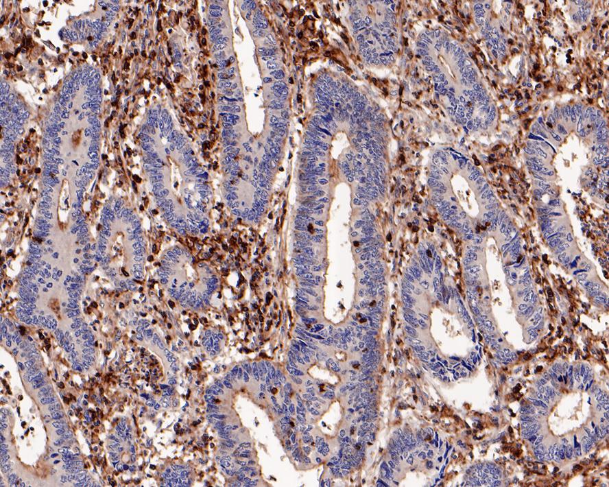 Suppressive Myeloid Cell Phenotyping IHC Antibody Sampler Kit