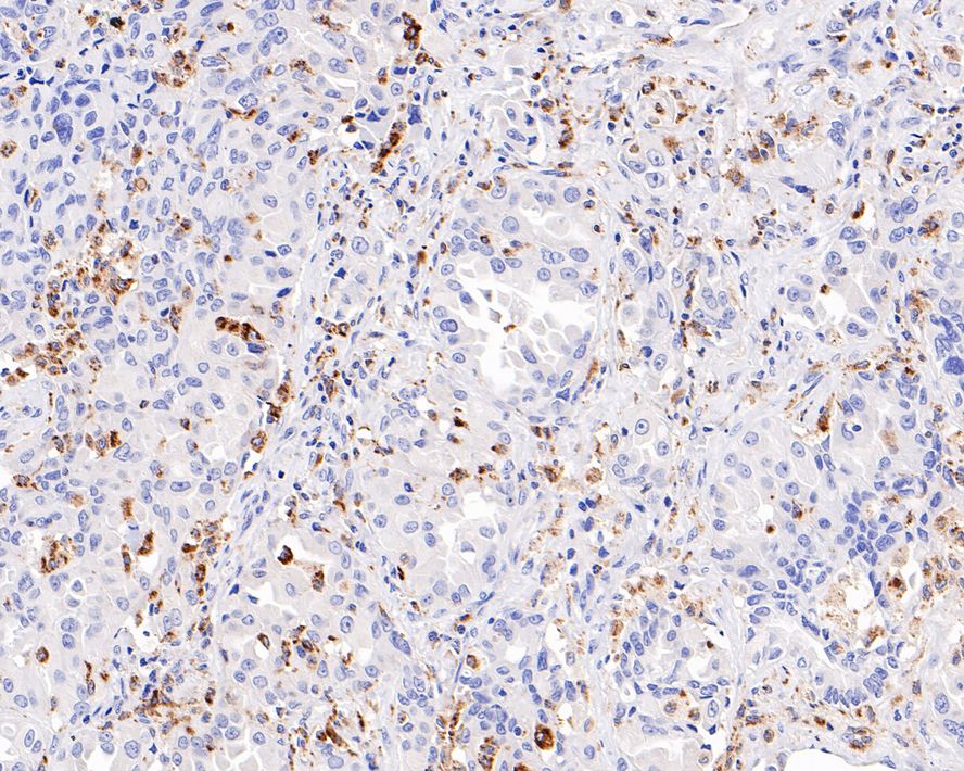 Suppressive Myeloid Cell Phenotyping IHC Antibody Sampler Kit