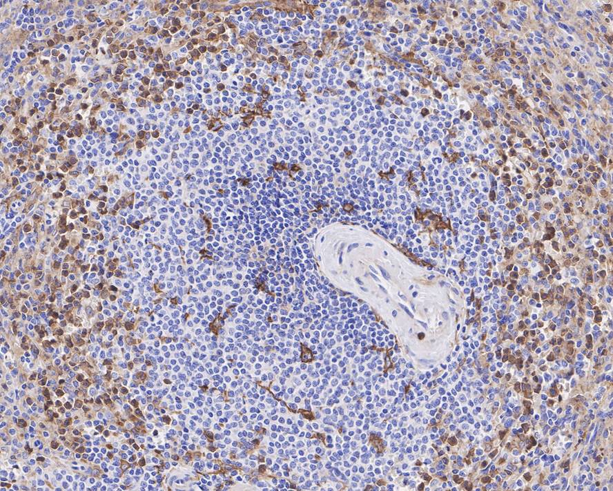 Suppressive Myeloid Cell Phenotyping IHC Antibody Sampler Kit