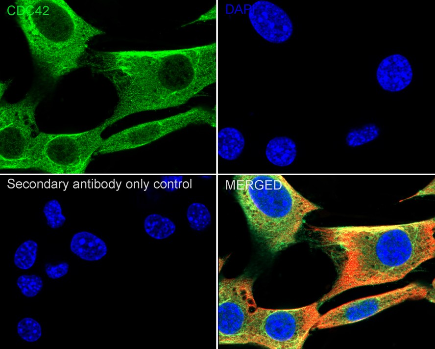 Actin Nucleation and Polymerization Antibody Sampler Kit