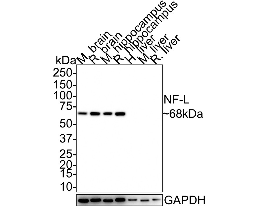 Neurofilament Antibody Sampler Kit