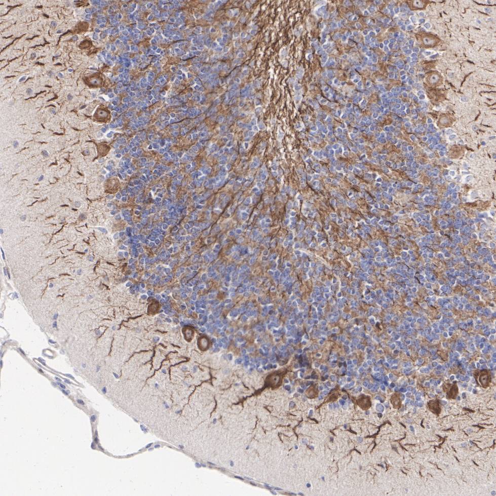 Neurofilament Antibody Sampler Kit