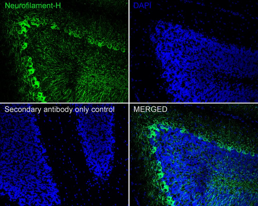 Neurofilament Antibody Sampler Kit