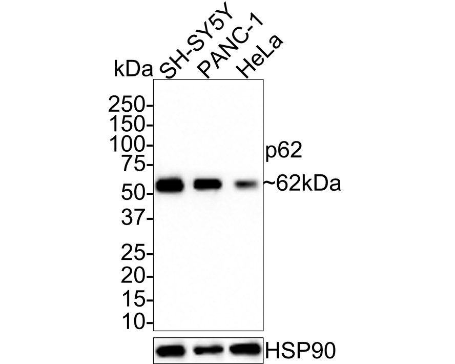 Sequestosome Signaling Antibody Sampler Kit