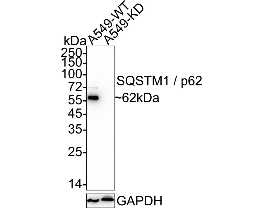 Sequestosome Signaling Antibody Sampler Kit