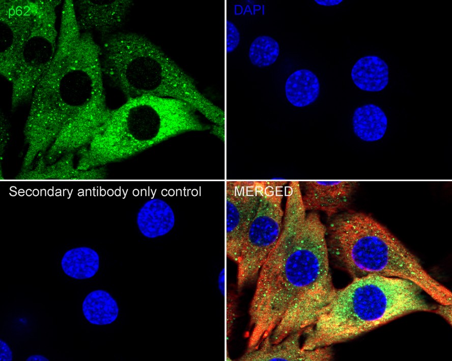 Sequestosome Signaling Antibody Sampler Kit