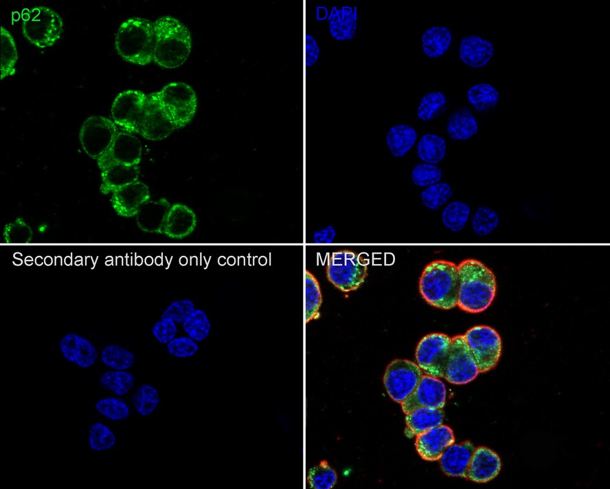 Sequestosome Signaling Antibody Sampler Kit