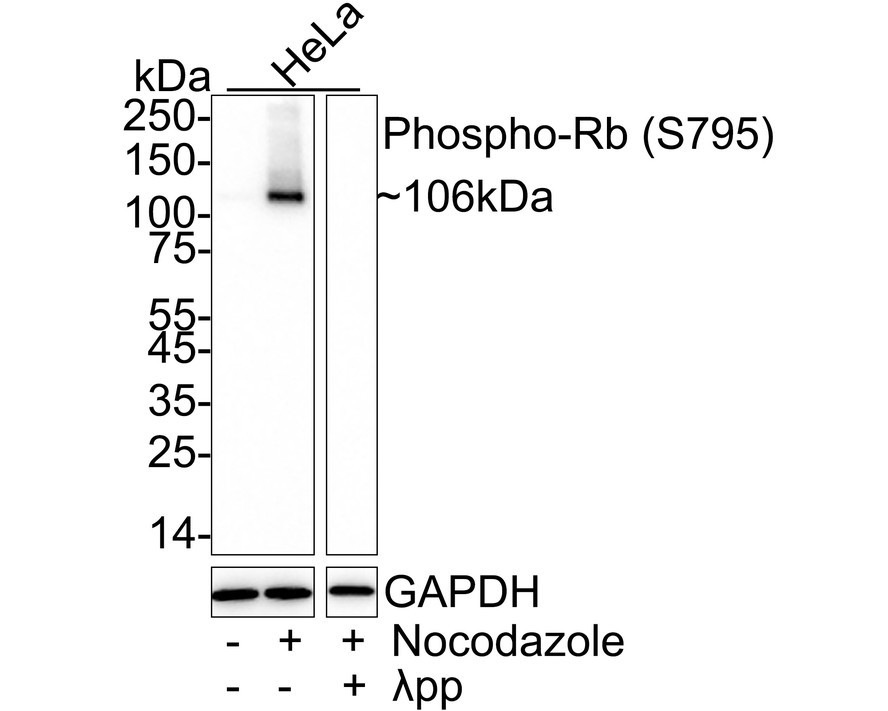 Rb Antibody Sampler Kit