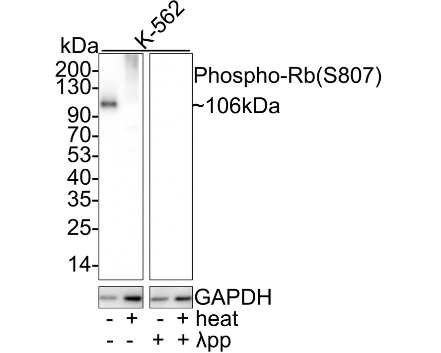 Rb Antibody Sampler Kit