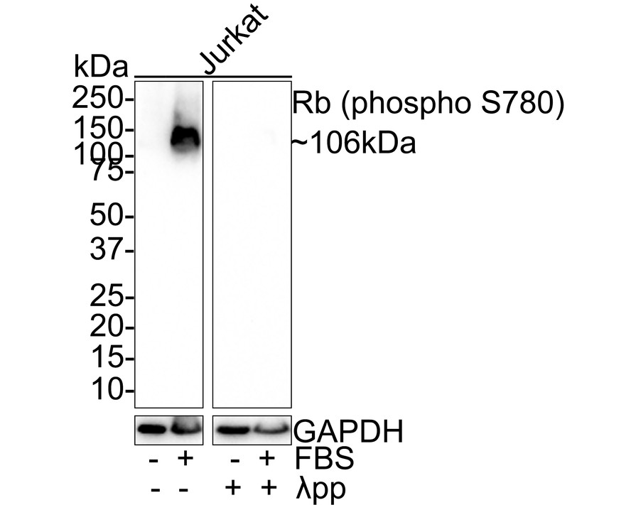 Rb Antibody Sampler Kit