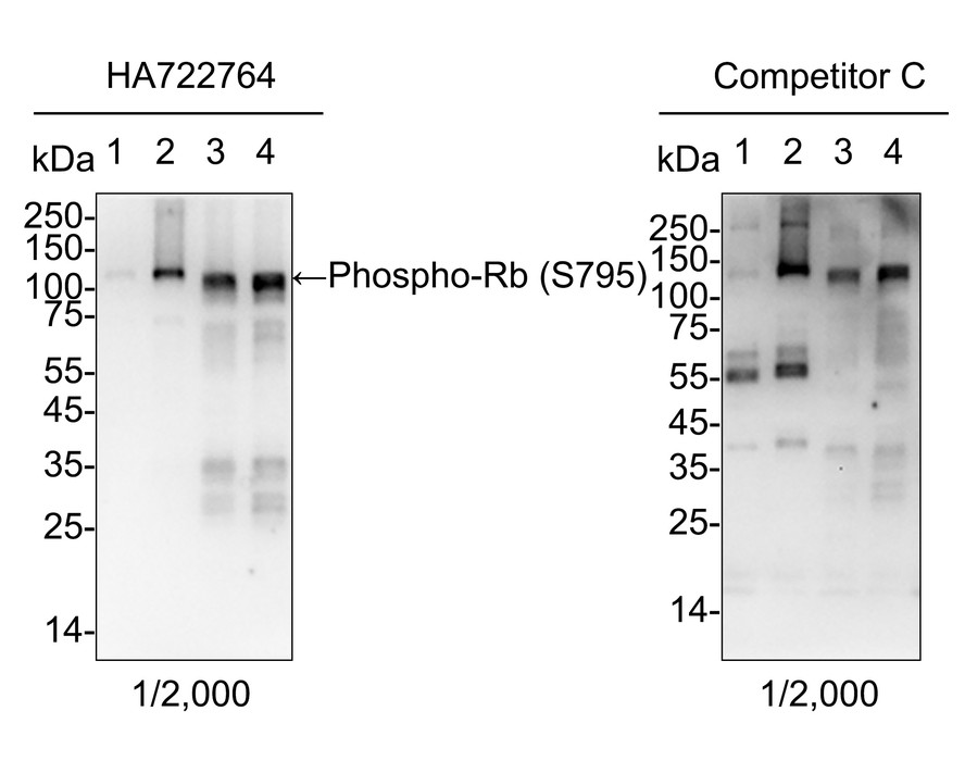 Rb Antibody Sampler Kit