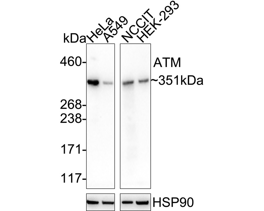 Double Strand Breaks (DSB) Repair Antibody Sampler Kit