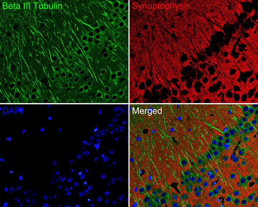 Immunofluorescence analysis of paraffin-embedded mouse hippocampus tissue labeling Beta III Tubulin (<a href="/products/M0805-8" style="font-weight: bold;text-decoration: underline;">M0805-8</a>) and Synaptophysin (ET1606-56).<br /><br />The section was pre-treated using heat mediated antigen retrieval with Tris-EDTA buffer (pH 9.0) for 20 minutes. The tissues were blocked in 10% negative goat serum for 1 hour at room temperature, washed with PBS. And then probed with the primary antibodies Beta III Tubulin (<a href="/products/M0805-8" style="font-weight: bold;text-decoration: underline;">M0805-8</a>, green) at 1/200 dilution and Synaptophysin (<a href="/products/ET1606-56" style="font-weight: bold;text-decoration: underline;">ET1606-56</a>, red) at 1/200 dilution overnight at 4 ℃, washed with PBS.<br /><br />Alexa Fluor&reg; 488 conjugate-Goat anti-Mouse IgG and Alexa Fluor&reg; 594 conjugate-Goat anti-Rabbit IgG were used as the secondary antibodies at 1/500 dilution. DAPI was used as nuclear counterstain.