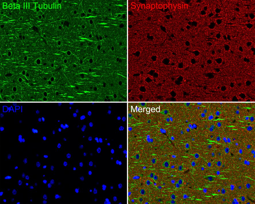 Immunofluorescence analysis of paraffin-embedded rat brain tissue labeling Beta III Tubulin (<a href="/products/M0805-8" style="font-weight: bold;text-decoration: underline;">M0805-8</a>) and Synaptophysin (ET1606-56).<br /><br />The section was pre-treated using heat mediated antigen retrieval with Tris-EDTA buffer (pH 9.0) for 20 minutes. The tissues were blocked in 10% negative goat serum for 1 hour at room temperature, washed with PBS. And then probed with the primary antibodies Beta III Tubulin (<a href="/products/M0805-8" style="font-weight: bold;text-decoration: underline;">M0805-8</a>, green) at 1/200 dilution and Synaptophysin (<a href="/products/ET1606-56" style="font-weight: bold;text-decoration: underline;">ET1606-56</a>, red) at 1/200 dilution overnight at 4 ℃, washed with PBS.<br /><br />Alexa Fluor&reg; 488 conjugate-Goat anti-Mouse IgG and Alexa Fluor&reg; 594 conjugate-Goat anti-Rabbit IgG were used as the secondary antibodies at 1/500 dilution. DAPI was used as nuclear counterstain.