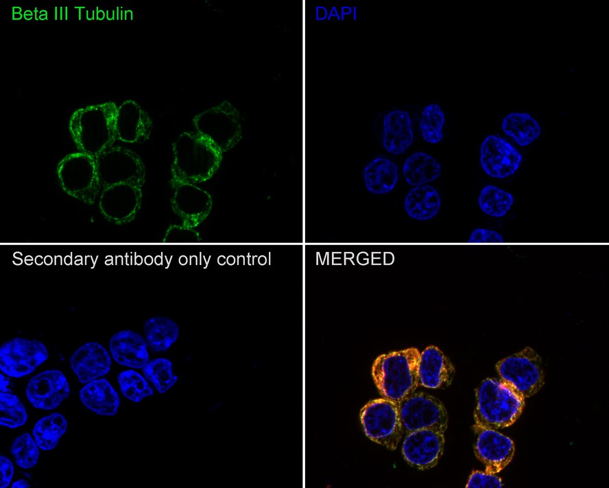 Immunocytochemistry analysis of HEK-293 cells labeling Beta III Tubulin with Mouse anti-Beta III Tubulin antibody (<a href="/products/M0805-8" style="font-weight: bold;text-decoration: underline;">M0805-8</a>) at 1/500 dilution.<br /><br />Cells were fixed in 4% paraformaldehyde for 20 minutes at room temperature, permeabilized with 0.1% Triton X-100 in PBS for 5 minutes at room temperature, then blocked with 1% BSA in 10% negative goat serum for 1 hour at room temperature. Cells were then incubated with Mouse anti-Beta III Tubulin antibody (<a href="/products/M0805-8" style="font-weight: bold;text-decoration: underline;">M0805-8</a>) at 1/500 dilution in 1% BSA in PBST overnight at 4 ℃. Goat Anti-Mouse IgG H&L (iFluor&trade; 488, <a href="/products/HA1125" style="font-weight: bold;text-decoration: underline;">HA1125</a>) was used as the secondary antibody at 1/1,000 dilution. PBS instead of the primary antibody was used as the secondary antibody only control. Nuclear DNA was labelled in blue with DAPI.<br /><br />beta Tubulin (<a href="/products/ET1602-4" style="font-weight: bold;text-decoration: underline;">ET1602-4</a>, red) was stained at 1/100 dilution overnight at +4℃. Goat Anti-Rabbit IgG H&L (iFluor&trade; 594, <a href="/products/HA1122" style="font-weight: bold;text-decoration: underline;">HA1122</a>) were used as the secondary antibody at 1/1,000 dilution.