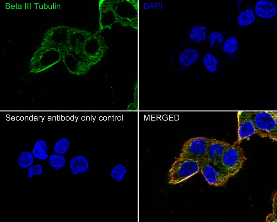 Immunocytochemistry analysis of SH-SY5Y cells labeling Beta III Tubulin with Mouse anti-Beta III Tubulin antibody (<a href="/products/M0805-8" style="font-weight: bold;text-decoration: underline;">M0805-8</a>) at 1/500 dilution.<br /><br />Cells were fixed in 4% paraformaldehyde for 20 minutes at room temperature, permeabilized with 0.1% Triton X-100 in PBS for 5 minutes at room temperature, then blocked with 1% BSA in 10% negative goat serum for 1 hour at room temperature. Cells were then incubated with Mouse anti-Beta III Tubulin antibody (<a href="/products/M0805-8" style="font-weight: bold;text-decoration: underline;">M0805-8</a>) at 1/500 dilution in 1% BSA in PBST overnight at 4 ℃. Goat Anti-Mouse IgG H&L (iFluor&trade; 488, <a href="/products/HA1125" style="font-weight: bold;text-decoration: underline;">HA1125</a>) was used as the secondary antibody at 1/1,000 dilution. PBS instead of the primary antibody was used as the secondary antibody only control. Nuclear DNA was labelled in blue with DAPI.<br /><br />beta Tubulin (<a href="/products/ET1602-4" style="font-weight: bold;text-decoration: underline;">ET1602-4</a>, red) was stained at 1/100 dilution overnight at +4℃. Goat Anti-Rabbit IgG H&L (iFluor&trade; 594, <a href="/products/HA1122" style="font-weight: bold;text-decoration: underline;">HA1122</a>) were used as the secondary antibody at 1/1,000 dilution.