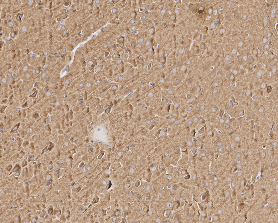 Immunohistochemical analysis of paraffin-embedded rat brain tissue with Mouse anti-Beta III Tubulin antibody (<a href="/products/M0805-8" style="font-weight: bold;text-decoration: underline;">M0805-8</a>) at 1/2,000 dilution.<br /><br />The section was pre-treated using heat mediated antigen retrieval with Tris-EDTA buffer (pH 9.0) for 20 minutes. The tissues were blocked in 1% BSA for 20 minutes at room temperature, washed with ddH<sub>2</sub>O and PBS, and then probed with the primary antibody (<a href="/products/M0805-8" style="font-weight: bold;text-decoration: underline;">M0805-8</a>) at 1/2,000 dilution for 1 hour at room temperature. The detection was performed using an HRP conjugated compact polymer system. DAB was used as the chromogen. Tissues were counterstained with hematoxylin and mounted with DPX.