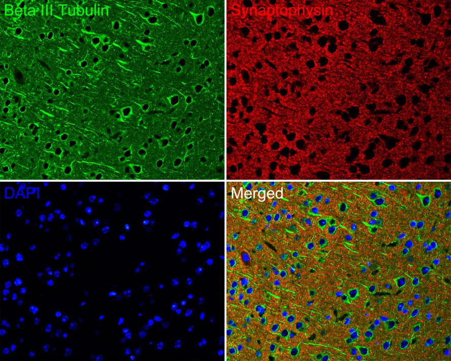 Immunofluorescence analysis of paraffin-embedded mouse brain tissue labeling Beta III Tubulin (<a href="/products/M0805-8" style="font-weight: bold;text-decoration: underline;">M0805-8</a>) and Synaptophysin (ET1606-56).<br /><br />The section was pre-treated using heat mediated antigen retrieval with Tris-EDTA buffer (pH 9.0) for 20 minutes. The tissues were blocked in 10% negative goat serum for 1 hour at room temperature, washed with PBS. And then probed with the primary antibodies Beta III Tubulin (<a href="/products/M0805-8" style="font-weight: bold;text-decoration: underline;">M0805-8</a>, green) at 1/200 dilution and Synaptophysin (<a href="/products/ET1606-56" style="font-weight: bold;text-decoration: underline;">ET1606-56</a>, red) at 1/200 dilution overnight at 4 ℃, washed with PBS.<br /><br />Alexa Fluor&reg; 488 conjugate-Goat anti-Mouse IgG and Alexa Fluor&reg; 594 conjugate-Goat anti-Rabbit IgG were used as the secondary antibodies at 1/500 dilution. DAPI was used as nuclear counterstain.