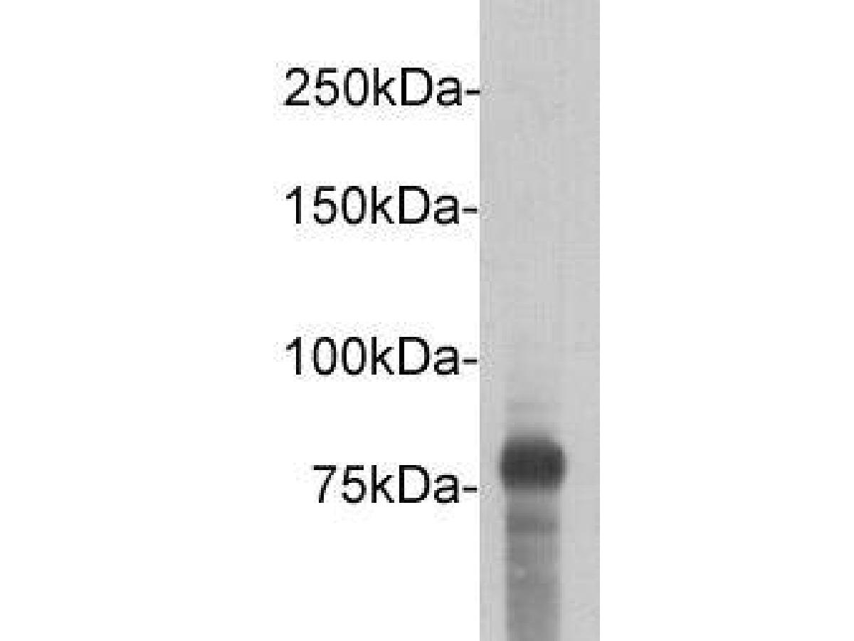 Western blot analysis of DYKDDDDK Tag (FLAG) on DYKDDDDK Tag recombinant protein (80kDa). Proteins were transferred to a PVDF membrane and blocked with 5% BSA in PBS for 1 hour at room temperature. The primary antibody (<a href="/products/0912-1" style="font-weight: bold;text-decoration: underline;">0912-1</a>, 1/5,000) was used in 5% BSA at room temperature for 2 hours. Goat Anti-Rabbit IgG - HRP Secondary Antibody (<a href="/products/HA1001" style="font-weight: bold;text-decoration: underline;">HA1001</a>) at 1:5,000 dilution was used for 1 hour at room temperature.