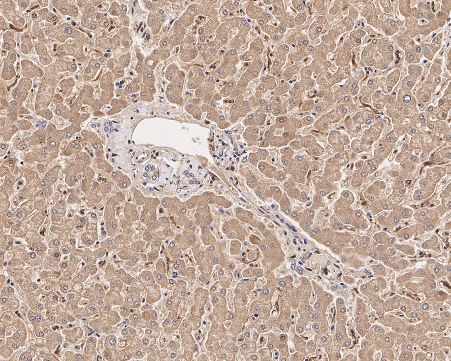 Promote the development of life sciences, high-quality monoclonal antibodies, polyclonal antibodies, proteins, and kits | HUABIO Promote the development of life sciences, high-quality monoclonal antibodies, polyclonal antibodies, proteins, and kits | HUABIO