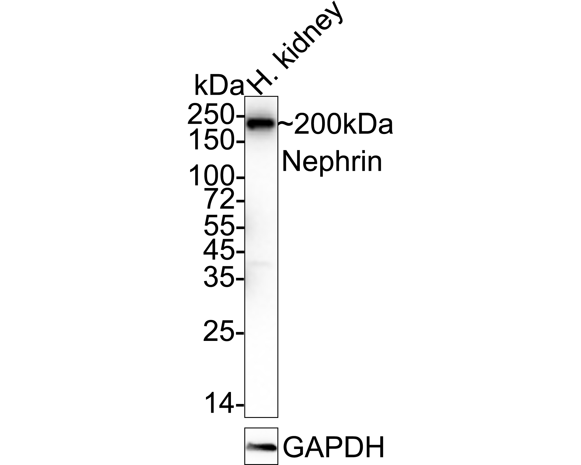 Nephrin Rabbit 推动生命科学发展,优质单抗,多抗,蛋白,试剂盒| HUABIO华安生物
