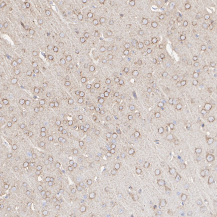 Immunohistochemical analysis of paraffin-embedded mouse brain tissue with Rabbit anti-LRP1 antibody (<a href=
