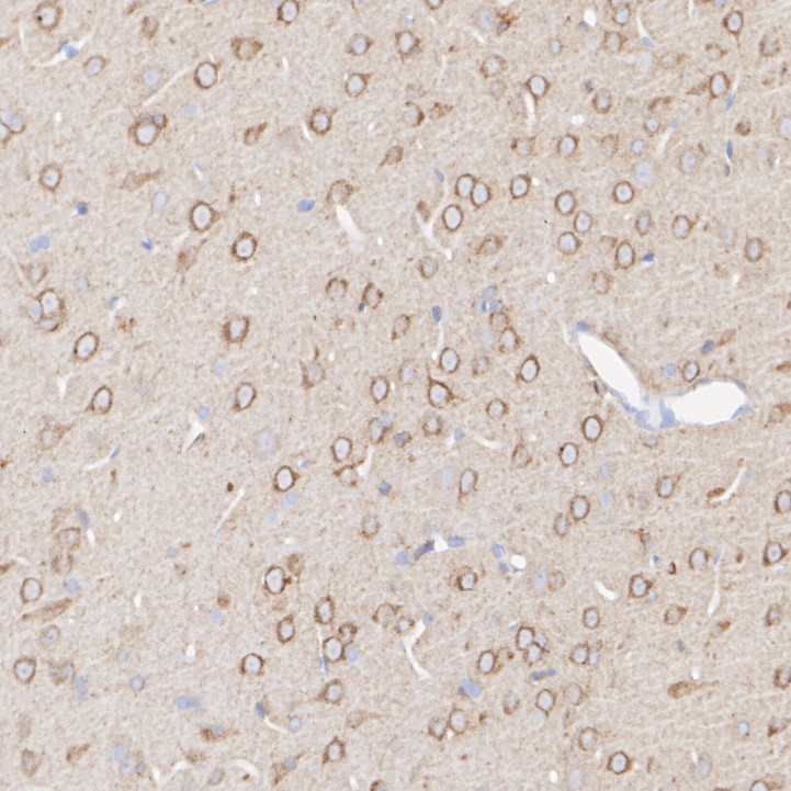 Immunohistochemical analysis of paraffin-embedded rat brain tissue with Rabbit anti-LRP1 antibody (<a href=