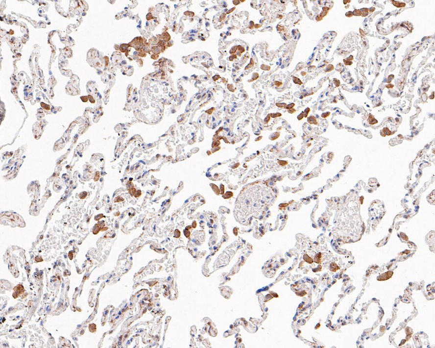 Immunohistochemical analysis of paraffin-embedded human lung tissue with Rabbit anti-LRP1 antibody (<a href=