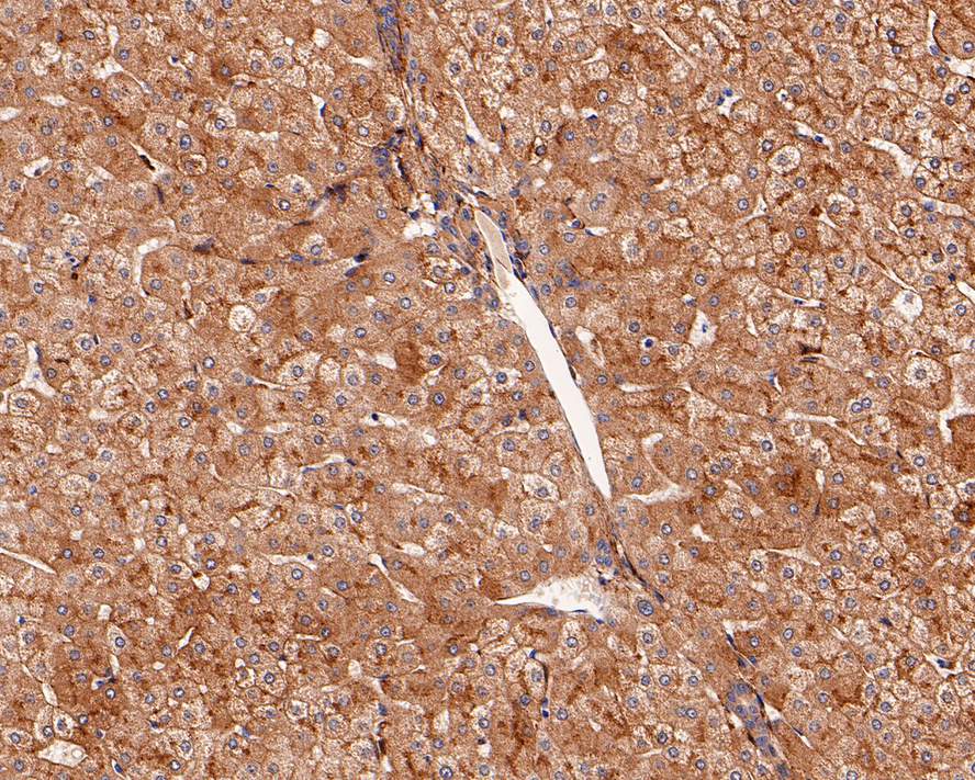 Immunohistochemical analysis of paraffin-embedded human liver tissue with Rabbit anti-LRP1 antibody (<a href=