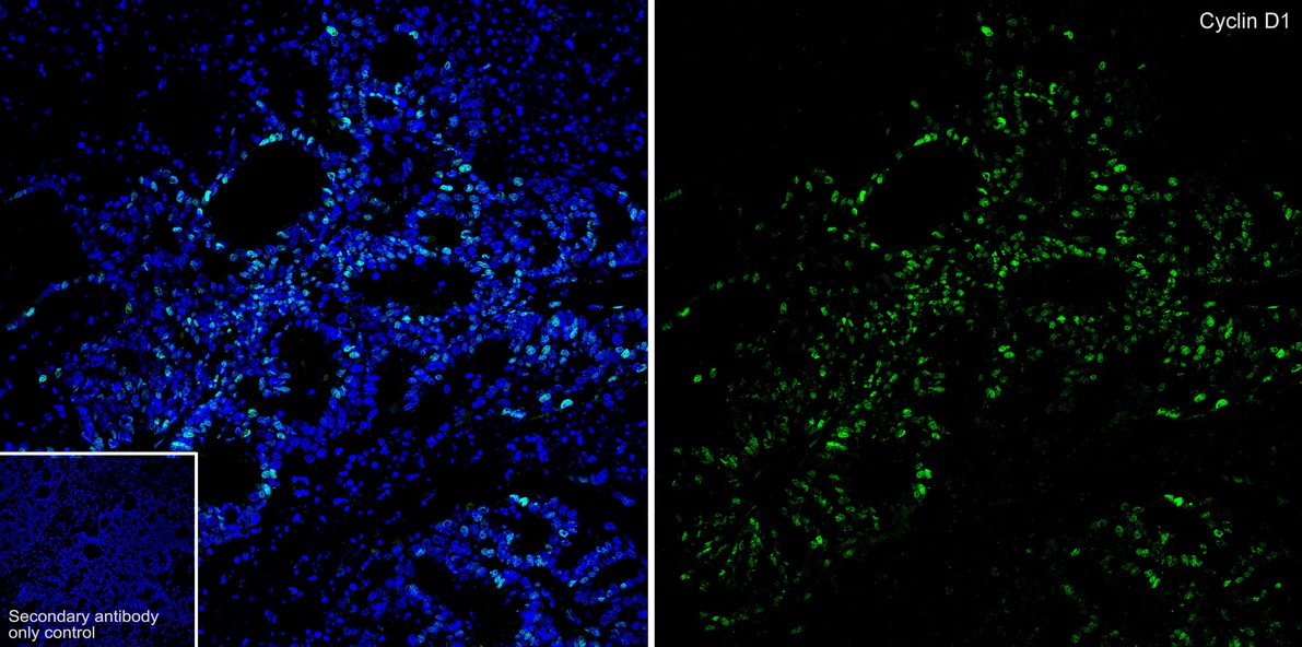 <span style="font-weight: bold;">☑ Relative expression (RE)</span><br /><br />Immunocytochemistry analysis of SH-SY5Y (positive) and 293T (negative) labeling Cyclin D1 with Rabbit anti-Cyclin D1 antibody (<a href="/products/ET1601-31" style="font-weight: bold;text-decoration: underline;">ET1601-31</a>) at 1/2,000 dilution.<br /><br />Cells were fixed in 4% paraformaldehyde for 20 minutes at room temperature, permeabilized with 0.1% Triton X-100 in PBS for 5 minutes at room temperature, then blocked with 1% BSA in 10% negative goat serum for 1 hour at room temperature. Cells were then incubated with Rabbit anti-Cyclin D1 antibody (<a href="/products/ET1601-31" style="font-weight: bold;text-decoration: underline;">ET1601-31</a>) at 1/2,000 dilution in 1% BSA in PBST overnight at 4 ℃. Goat Anti-Rabbit IgG H&L (iFluor™ 488, <a href="/products/HA1121" style="font-weight: bold;text-decoration: underline;">HA1121</a>) was used as the secondary antibody at 1/1,000 dilution. PBS instead of the primary antibody was used as the secondary antibody only control. Nuclear DNA was labelled in blue with DAPI.<br /><br />Beta tubulin (<a href="/products/M1305-2" style="font-weight: bold;text-decoration: underline;">M1305-2</a>, red) was stained at 1/100 dilution overnight at +4℃. Goat Anti-Mouse IgG H&L (iFluor™ 594, <a href="/products/HA1126" style="font-weight: bold;text-decoration: underline;">HA1126</a>) was used as the secondary antibody at 1/1,000 dilution.