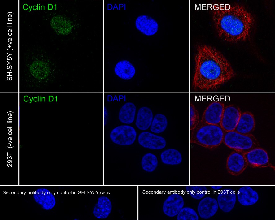 Immunocytochemistry analysis of C6 cells labeling Cyclin D1 with Rabbit anti-Cyclin D1 antibody (<a href="/products/ET1601-31" style="font-weight: bold;text-decoration: underline;">ET1601-31</a>) at 1/2,000 dilution.<br /><br />Cells were fixed in 4% paraformaldehyde for 20 minutes at room temperature, permeabilized with 0.1% Triton X-100 in PBS for 5 minutes at room temperature, then blocked with 1% BSA in 10% negative goat serum for 1 hour at room temperature. Cells were then incubated with Rabbit anti-Cyclin D1 antibody (<a href="/products/ET1601-31" style="font-weight: bold;text-decoration: underline;">ET1601-31</a>) at 1/2,000 dilution in 1% BSA in PBST overnight at 4 ℃. Goat Anti-Rabbit IgG H&L (iFluor™ 488, <a href="/products/HA1121" style="font-weight: bold;text-decoration: underline;">HA1121</a>) was used as the secondary antibody at 1/1,000 dilution. PBS instead of the primary antibody was used as the secondary antibody only control. Nuclear DNA was labelled in blue with DAPI.<br /><br />Beta tubulin (<a href="/products/M1305-2" style="font-weight: bold;text-decoration: underline;">M1305-2</a>, red) was stained at 1/100 dilution overnight at +4℃. Goat Anti-Mouse IgG H&L (iFluor™ 594, <a href="/products/HA1126" style="font-weight: bold;text-decoration: underline;">HA1126</a>) was used as the secondary antibody at 1/1,000 dilution.