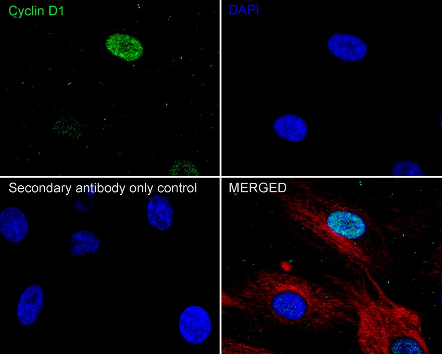 Cyclin D1 was immunoprecipitated from 0.2 mg MCF7 cell lysate with <a href="/products/ET1601-31" style="font-weight: bold;text-decoration: underline;">ET1601-31</a> at 2 µg/25 µl agarose. Western blot was performed from the immunoprecipitate using <a href="/products/ET1601-31" style="font-weight: bold;text-decoration: underline;">ET1601-31</a> at 1/1,000 dilution. Anti-Rabbit IgG for IP Nano-secondary antibody (<a href="/products/NBI01H" style="font-weight: bold;text-decoration: underline;">NBI01H</a>) at 1/5,000 dilution was used for 1 hour at room temperature.<br /><br />Lane 1: MCF7 cell lysate (input)<br />Lane 2: <a href="/products/ET1601-31" style="font-weight: bold;text-decoration: underline;">ET1601-31</a> IP in MCF7 cell lysate<br />Lane 3: Rabbit IgG instead of <a href="/products/ET1601-31" style="font-weight: bold;text-decoration: underline;">ET1601-31</a> in MCF7 cell lysate<br /><br />Blocking/Dilution buffer: 5% NFDM/TBST<br />Exposure time: 5 seconds; ECL: K1802