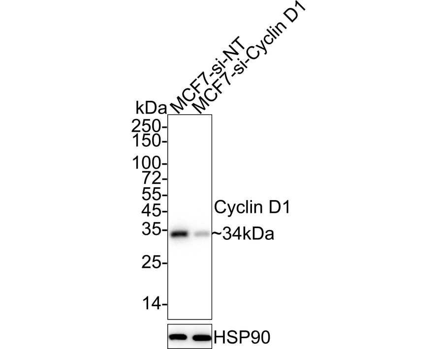 <span style="font-weight: bold;">☑ Knockdown (KD)</span><br /><br />Western blot analysis of Cyclin D1 on different lysates with Rabbit anti-Cyclin D1 antibody (<a href="/products/ET1601-31" style="font-weight: bold;text-decoration: underline;">ET1601-31</a>) at 1/5,000 dilution.<br /><br />Lane 1: MCF7-si NT cell lysate<br />Lane 2: MCF7-si Cyclin D1 cell lysate<br /><br />Lysates/proteins at 10 µg/Lane.<br /><br />Predicted band size: 34 kDa<br />Observed band size: 34 kDa<br /><br />Exposure time: 17 seconds; ECL: K1801;<br />4-20% SDS-PAGE gel.<br /><br />Proteins were transferred to a PVDF membrane and blocked with 5% NFDM/TBST for 1 hour at room temperature. The primary antibody (<a href="/products/ET1601-31" style="font-weight: bold;text-decoration: underline;">ET1601-31</a>) at 1/5,000 dilution was used in 5% NFDM/TBST at 4℃ overnight. Goat Anti-Rabbit IgG - HRP Secondary Antibody (<a href="/products/HA1001" style="font-weight: bold;text-decoration: underline;">HA1001</a>) at 1/50,000 dilution was used for 1 hour at room temperature.