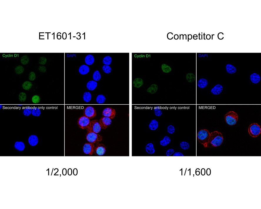 Cyclin D1 was immunoprecipitated from 0.5 mg Hela whole cell lysates with <a href="/products/ET1601-31" style="font-weight: bold;text-decoration: underline;">ET1601-31</a> at 2 μg/mL. Western blot was performed from the immunoprecipitate using <a href="/products/ET1601-31" style="font-weight: bold;text-decoration: underline;">ET1601-31</a> at 1/500 dilution for 45 minutes at room temperature. Goat anti-Rabbit IgG-HRP Secondary Antibody (<a href="/products/HA1001" style="font-weight: bold;text-decoration: underline;">HA1001</a>) was used at 1:300,000 dilution for 30 minutes at room temperature.<br /><br />Lane 1: Hela whole cell lysates at 10 μg;<br />Lane 2: Cyclin D1 (<a href="/products/ET1601-31" style="font-weight: bold;text-decoration: underline;">ET1601-31</a>) IP in Hela whole cell lysates;<br />Lane 3: Rabbit IgG instead of Cyclin D1 (<a href="/products/ET1601-31" style="font-weight: bold;text-decoration: underline;">ET1601-31</a>) in Hela whole cell lysates.<br /><br />Predicted band size: 34 kDa<br />Observed band size: 34 kDa<br /><br />Exposure time: 5 minutes;<br /><br />12% SDS-PAGE gel.