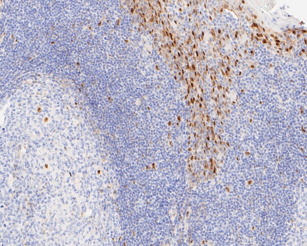 Immunohistochemical analysis of paraffin-embedded human tonsil tissue using anti-Cyclin D1 antibody. The section was pre-treated using heat mediated antigen retrieval with sodium citrate buffer (pH 6.0) for 2 minutes. The tissues were blocked in 5% BSA for 30 minutes at room temperature, washed with ddH<sub>2</sub>O and PBS, and then probed with the primary antibody (<a href="/products/ET1601-31" style="font-weight: bold;text-decoration: underline;">ET1601-31</a>, 1/200) for 30 minutes at room temperature. The detection was performed using an HRP conjugated compact polymer system. DAB was used as the chromogen. Tissues were counterstained with hematoxylin and mounted with DPX.