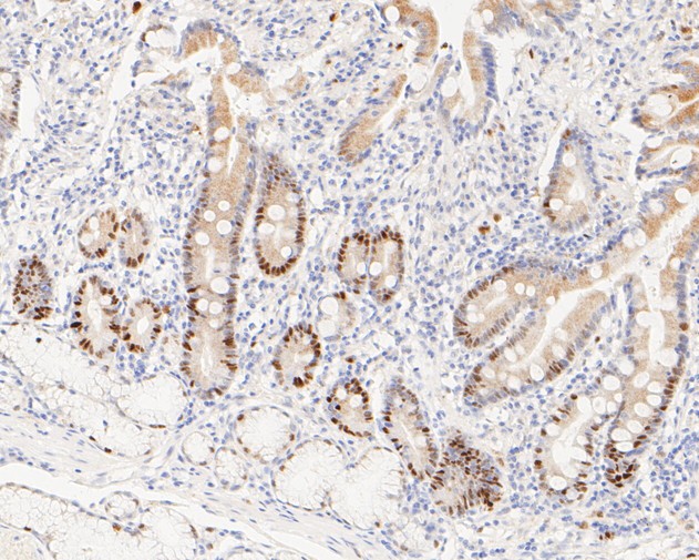 Immunohistochemical analysis of paraffin-embedded human small intestine tissue using anti-Cyclin D1 antibody. The section was pre-treated using heat mediated antigen retrieval with sodium citrate buffer (pH 6.0) for 2 minutes. The tissues were blocked in 5% BSA for 30 minutes at room temperature, washed with ddH<sub>2</sub>O and PBS, and then probed with the primary antibody (<a href="/products/ET1601-31" style="font-weight: bold;text-decoration: underline;">ET1601-31</a>, 1/200) for 30 minutes at room temperature. The detection was performed using an HRP conjugated compact polymer system. DAB was used as the chromogen. Tissues were counterstained with hematoxylin and mounted with DPX.