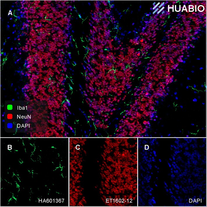 Application: IHC-Fr<br /><br />Species: Mouse<br /><br />Site: Cerebellum<br /><br />Sample: Frozen section<br /><br />Antibody concentration: 1: 1,000 (NeuN, <a href="/products/ET1602-12" style="font-weight: bold;text-decoration: underline;">ET1602-12</a>, red); 1:1,000 (Iba1, <a href="/products/HA601367" style="font-weight: bold;text-decoration: underline;">HA601367</a>, green)<br /><br />Antigen retrieval: Not required