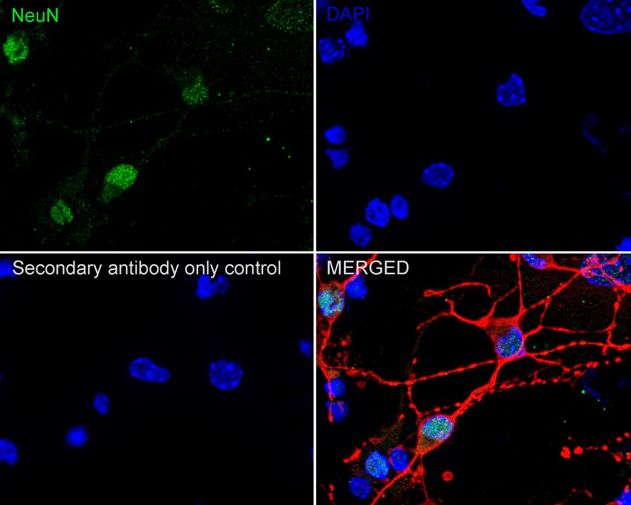 Immunocytochemistry analysis of primary mouse neurons/glia cells labeling NeuN with Rabbit anti-NeuN antibody (<a href="/products/ET1602-12" style="font-weight: bold;text-decoration: underline;">ET1602-12</a>) at 1/500 dilution.<br /><br />Cells were fixed with 4% PFA (15 min), permeabilized with 0.25% TritonX-100 for 15 minutes and then blocked with 1% BSA/10% normal goat serum/0.3M glycine in 0.1%PBS-Tween for 1h. The cells were then incubated overnight at 4℃ with Rabbit anti-NeuN antibody (<a href="/products/ET1602-12" style="font-weight: bold;text-decoration: underline;">ET1602-12</a>) at at 1/500 dilution. Goat Anti-Rabbit IgG H&L (iFluor™ 488, <a href="/products/HA1121" style="font-weight: bold;text-decoration: underline;">HA1121</a>) was used as the secondary antibody at 1/1,000 dilution. PBS instead of the primary antibody was used as the secondary antibody only control. Nuclear DNA was labelled in blue with DAPI.