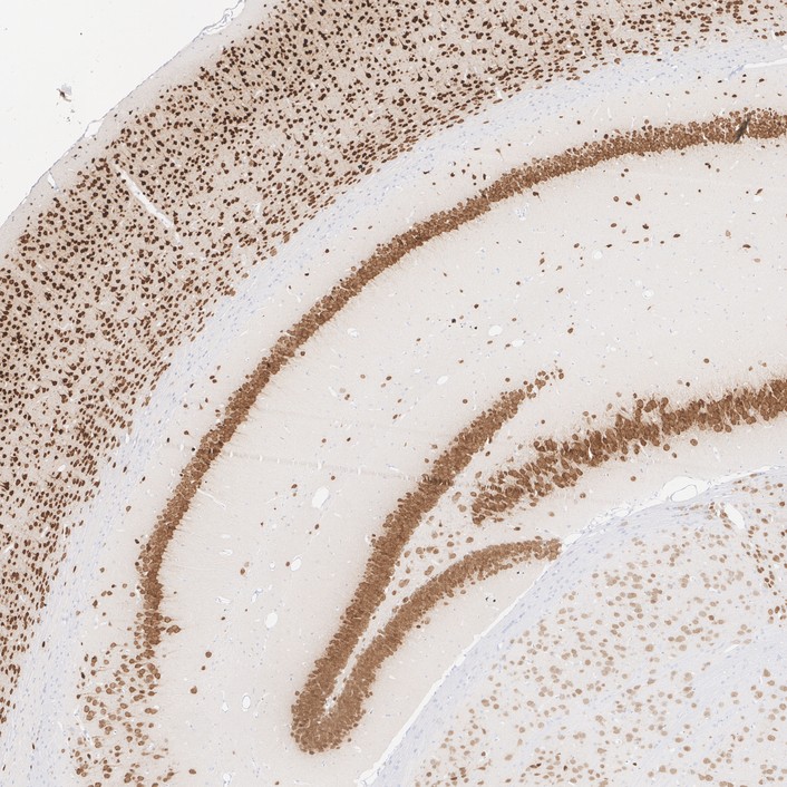Immunohistochemical analysis of paraffin-embedded mouse brain tissue with Rabbit anti-NeuN antibody (<a href="/products/ET1602-12" style="font-weight: bold;text-decoration: underline;">ET1602-12</a>) at 1/1,000 dilution.<br /><br />The section was pre-treated using heat mediated antigen retrieval with sodium citrate buffer (pH 6.0) for 2 minutes. The tissues were blocked in 1% BSA for 20 minutes at room temperature, washed with ddH<sub>2</sub>O and PBS, and then probed with the primary antibody (<a href="/products/ET1602-12" style="font-weight: bold;text-decoration: underline;">ET1602-12</a>) at 1/1,000 dilution for 1 hour at room temperature. The detection was performed using an HRP conjugated compact polymer system. DAB was used as the chromogen. Tissues were counterstained with hematoxylin and mounted with DPX.