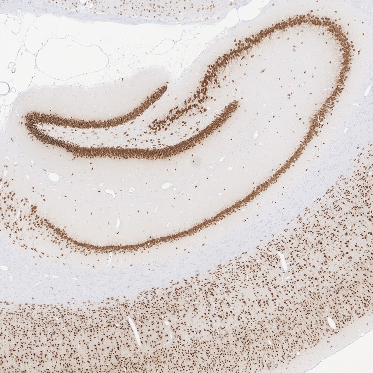 Immunohistochemical analysis of paraffin-embedded rat brain tissue with Rabbit anti-NeuN antibody (<a href="/products/ET1602-12" style="font-weight: bold;text-decoration: underline;">ET1602-12</a>) at 1/1,000 dilution.<br /><br />The section was pre-treated using heat mediated antigen retrieval with sodium citrate buffer (pH 6.0) for 2 minutes. The tissues were blocked in 1% BSA for 20 minutes at room temperature, washed with ddH<sub>2</sub>O and PBS, and then probed with the primary antibody (<a href="/products/ET1602-12" style="font-weight: bold;text-decoration: underline;">ET1602-12</a>) at 1/1,000 dilution for 1 hour at room temperature. The detection was performed using an HRP conjugated compact polymer system. DAB was used as the chromogen. Tissues were counterstained with hematoxylin and mounted with DPX.