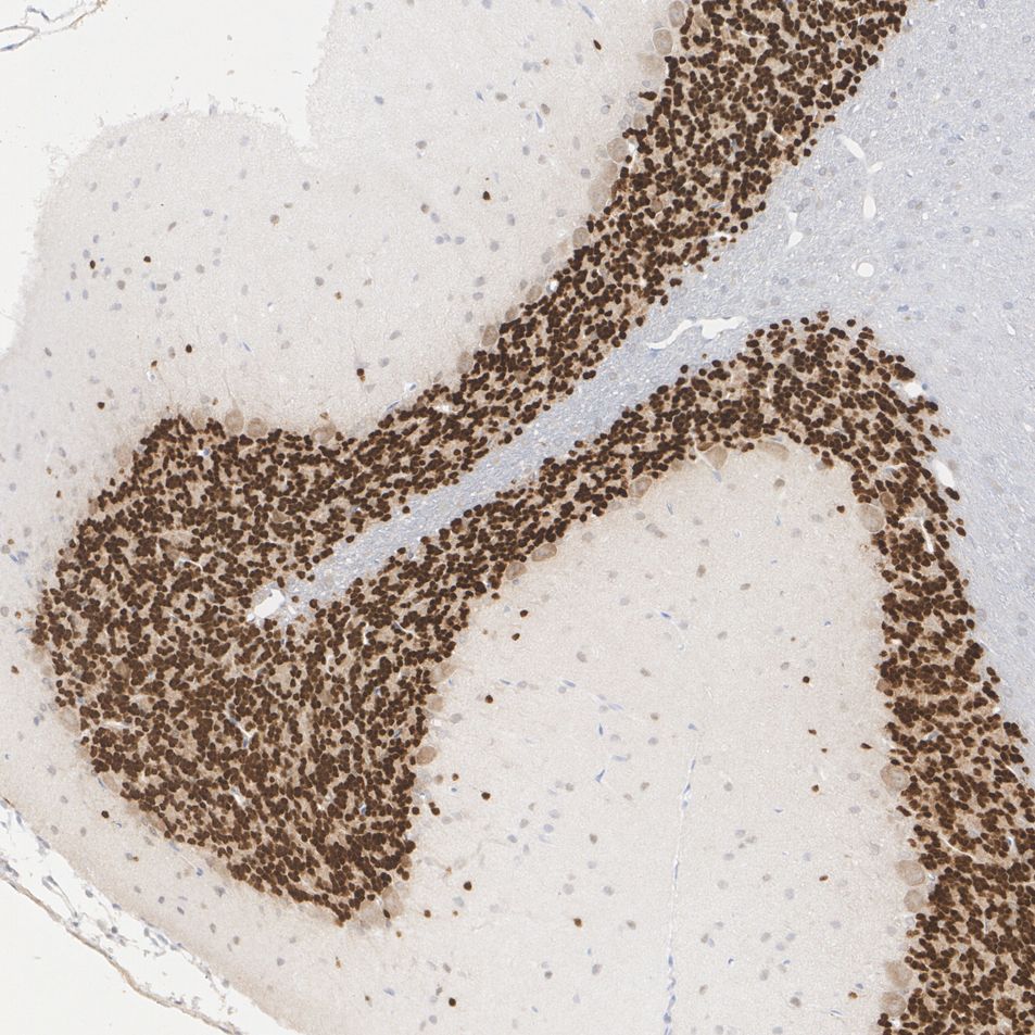 Immunohistochemical analysis of paraffin-embedded rat cerebellum tissue with Rabbit anti-NeuN antibody (<a href="/products/ET1602-12" style="font-weight: bold;text-decoration: underline;">ET1602-12</a>) at 1/1,000 dilution.<br /><br />The section was pre-treated using heat mediated antigen retrieval with sodium citrate buffer (pH 6.0) for 2 minutes. The tissues were blocked in 1% BSA for 20 minutes at room temperature, washed with ddH<sub>2</sub>O and PBS, and then probed with the primary antibody (<a href="/products/ET1602-12" style="font-weight: bold;text-decoration: underline;">ET1602-12</a>) at 1/1,000 dilution for 1 hour at room temperature. The detection was performed using an HRP conjugated compact polymer system. DAB was used as the chromogen. Tissues were counterstained with hematoxylin and mounted with DPX.