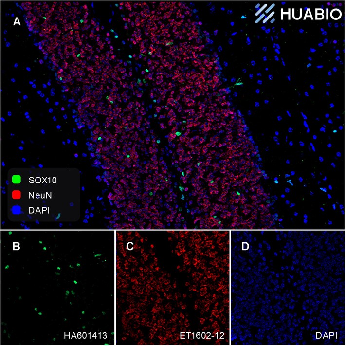 Application: IHC-Fr<br /><br />Species: Mouse<br /><br />Site: Cerebellum<br /><br />Sample: Frozen section<br /><br />Antibody concentration: 1: 2,000 (NeuN, <a href="/products/ET1602-12" style="font-weight: bold;text-decoration: underline;">ET1602-12</a>, red); 1:1,000 (SOX10, <a href="/products/HA601413" style="font-weight: bold;text-decoration: underline;">HA601413</a>, green)<br /><br />Antigen retrieval: Not required