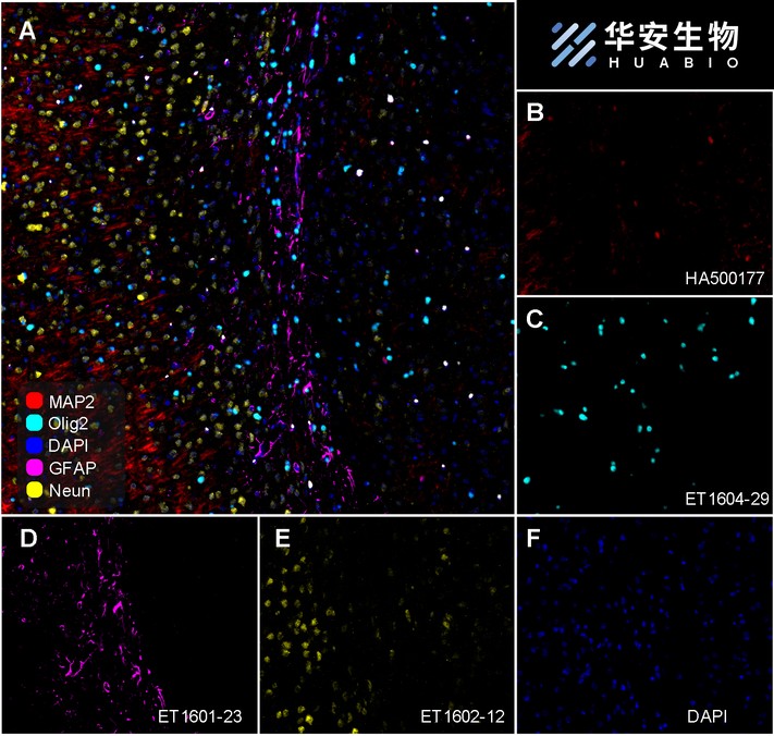 Fluorescence multiplex immunohistochemical analysis of mouse brain (Formalin/PFA-fixed paraffin-embedded sections). Panel A: the merged image of anti-MAP2 (<a href="/products/HA500177" style="font-weight: bold;text-decoration: underline;">HA500177</a>, Red), anti-Olig2 (<a href="/products/ET1604-29" style="font-weight: bold;text-decoration: underline;">ET1604-29</a>, Cyan), anti-GFAP (<a href="/products/ET1601-23" style="font-weight: bold;text-decoration: underline;">ET1601-23</a>, Magenta) and anti-Neun (<a href="/products/ET1602-12" style="font-weight: bold;text-decoration: underline;">ET1602-12</a>, Yellow) on mouse brain. HRP Conjugated UltraPolymer Goat Polyclonal Antibody HA1119/HA1120 was used as a secondary antibody. The immunostaining was performed with the Sequential Immuno-staining Kit (IRISKit™MH010101, www.luminiris.cn). The section was incubated in four rounds of staining: in the order of <a href="/products/HA500177" style="font-weight: bold;text-decoration: underline;">HA500177</a> (1/1,000 dilution), <a href="/products/ET1604-29" style="font-weight: bold;text-decoration: underline;">ET1604-29</a> (1/5,000 dilution), <a href="/products/ET1601-23" style="font-weight: bold;text-decoration: underline;">ET1601-23</a> (1/10,000 dilution) and <a href="/products/ET1602-12" style="font-weight: bold;text-decoration: underline;">ET1602-12</a> (1/10,000 dilution) for 20 mins at room temperature. Each round was followed by a separate fluorescent tyramide signal amplification system. Heat mediated antigen retrieval with Tris-EDTA buffer (pH 9.0) for 30 mins at 95℃. DAPI (blue) was used as a nuclear counter stain. Image acquisition was performed with Olympus VS200 Slide Scanner.