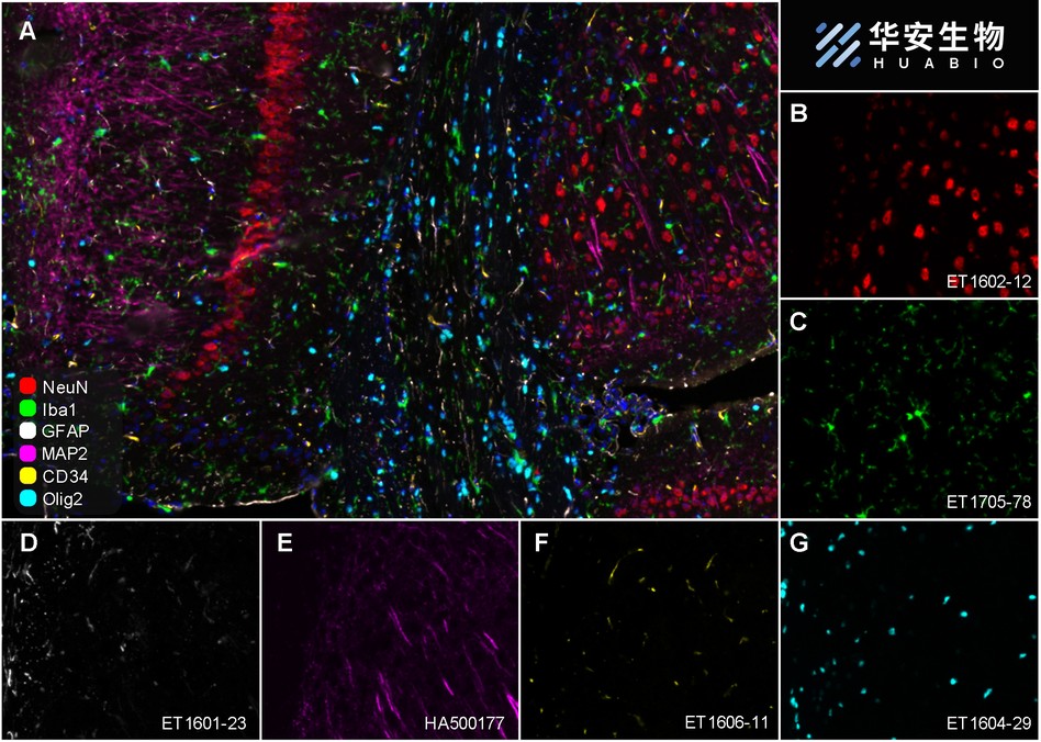 Fluorescence multiplex immunohistochemical analysis of mouse brain (Formalin/PFA-fixed paraffin-embedded sections). Panel A: the merged image of anti-NeuN (<a href="/products/ET1602-12" style="font-weight: bold;text-decoration: underline;">ET1602-12</a>, red), anti-Iba1 (<a href="/products/ET1705-78" style="font-weight: bold;text-decoration: underline;">ET1705-78</a>, green), anti-GFAP (<a href="/products/ET1601-23" style="font-weight: bold;text-decoration: underline;">ET1601-23</a>, gray), anti-Olig2 (<a href="/products/ET1604-29" style="font-weight: bold;text-decoration: underline;">ET1604-29</a>, cyan), anti-MAP2 (<a href="/products/HA500177" style="font-weight: bold;text-decoration: underline;">HA500177</a>, magenta) and anti-CD34 (<a href="/products/ET1606-11" style="font-weight: bold;text-decoration: underline;">ET1606-11</a>, yellow) on mouse brain. HRP Conjugated UltraPolymer Goat Polyclonal Antibody HA1119/HA1120 was used as a secondary antibody. The immunostaining was performed with the Sequential Immuno-staining Kit (IRISKit™MH010101, www.luminiris.cn). The section was incubated in six rounds of staining: in the order of <a href="/products/ET1602-12" style="font-weight: bold;text-decoration: underline;">ET1602-12</a>(1/5,000 dilution), <a href="/products/ET1705-78" style="font-weight: bold;text-decoration: underline;">ET1705-78</a> (1/2,000 dilution), <a href="/products/ET1601-23" style="font-weight: bold;text-decoration: underline;">ET1601-23</a> (1/5,000 dilution), <a href="/products/ET1604-29" style="font-weight: bold;text-decoration: underline;">ET1604-29</a> (1/1,000 dilution), <a href="/products/HA500177" style="font-weight: bold;text-decoration: underline;">HA500177</a> (1/5,000 dilution) and <a href="/products/ET1606-11" style="font-weight: bold;text-decoration: underline;">ET1606-11</a> (1/2,000 dilution) for 20 mins at room temperature. Each round was followed by a separate fluorescent tyramide signal amplification system. Heat mediated antigen retrieval with Tris-EDTA buffer (pH 9.0) for 30 mins at 95℃. DAPI (blue) was used as a nuclear counter stain. Image acquisition was performed with Olympus VS200 Slide Scanner.