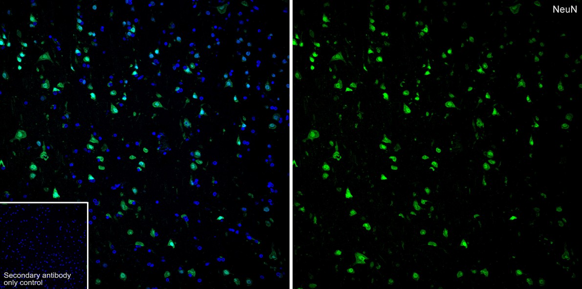 Application: IF-Tissue<br /><br />Species: Human<br /><br />Site: brain<br /><br />Sample: Paraffin-embedded section<br /><br />Antibody concentration: 1/500